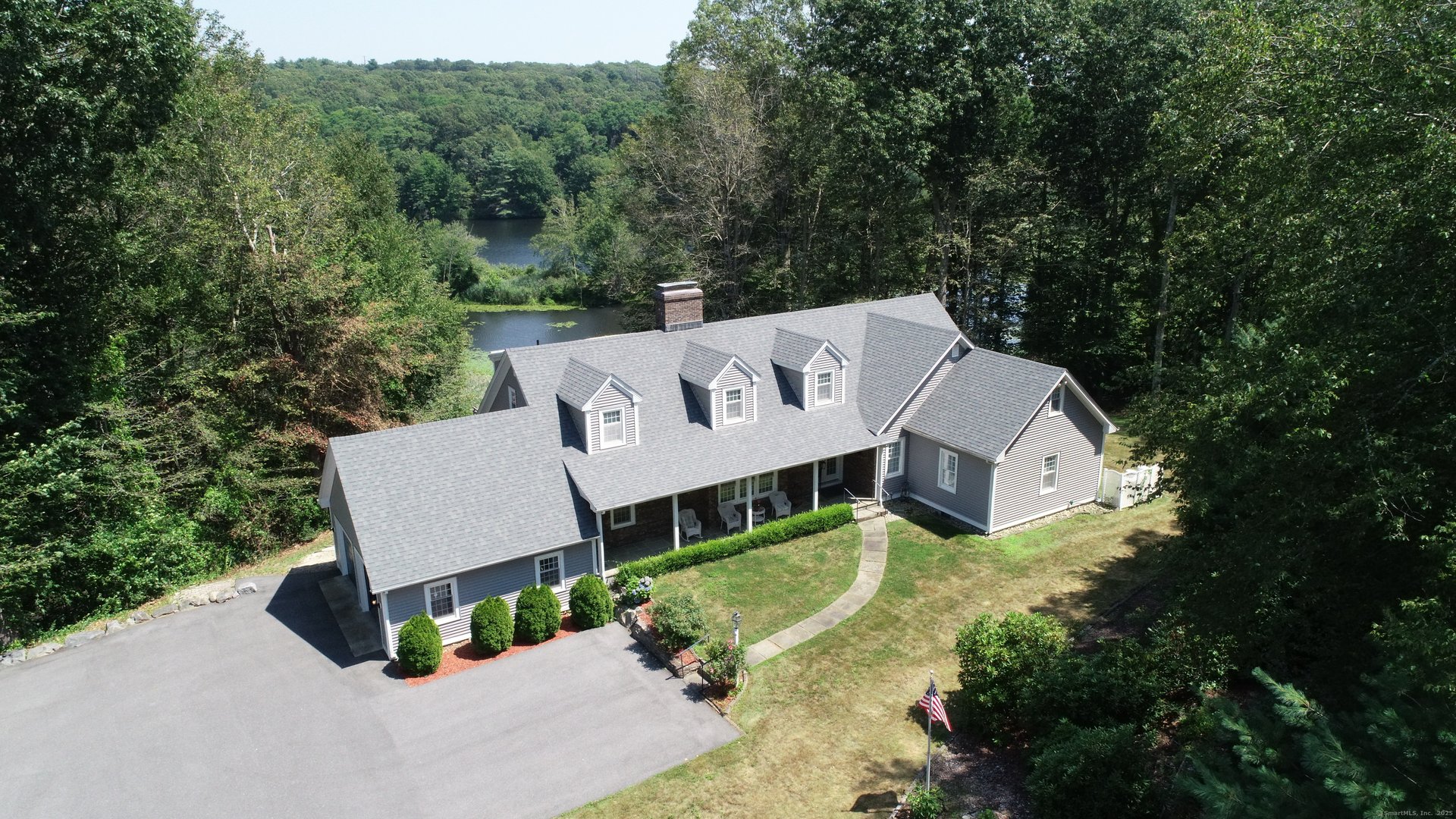 1 Lake Louise Drive Photo 30